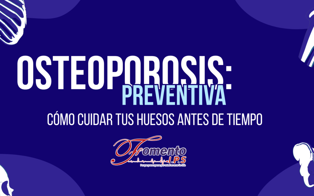 Osteoporosis preventiva: cómo cuidar tus huesos antes de tiempo
