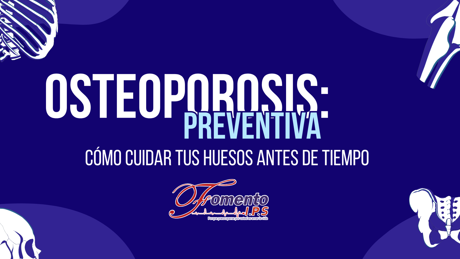Osteoporosis Preventiva